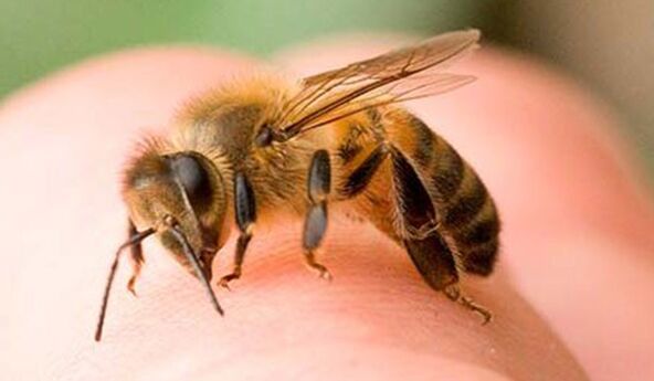 蜜蜂蜇伤 - 一种扩大阴茎的极端方式